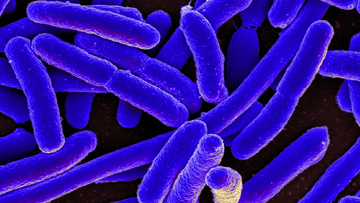 Ingekleurde elektronenmicroscoopopname van staafvormige Escherichia coli-bacteriën, felblauw tegen een donkere achtergrond